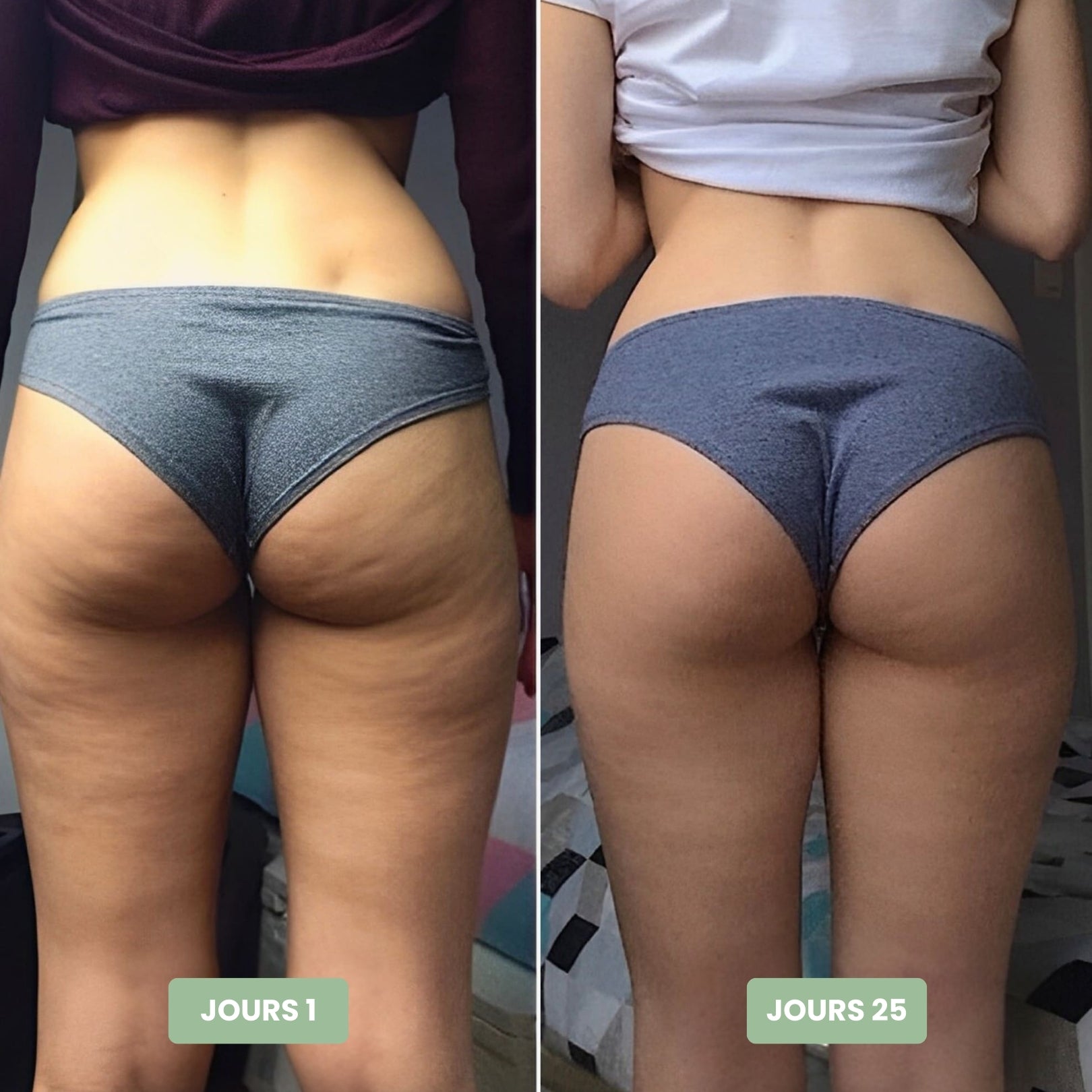 Vibraskin® - Appareil anti-cellulite à micro vibrations