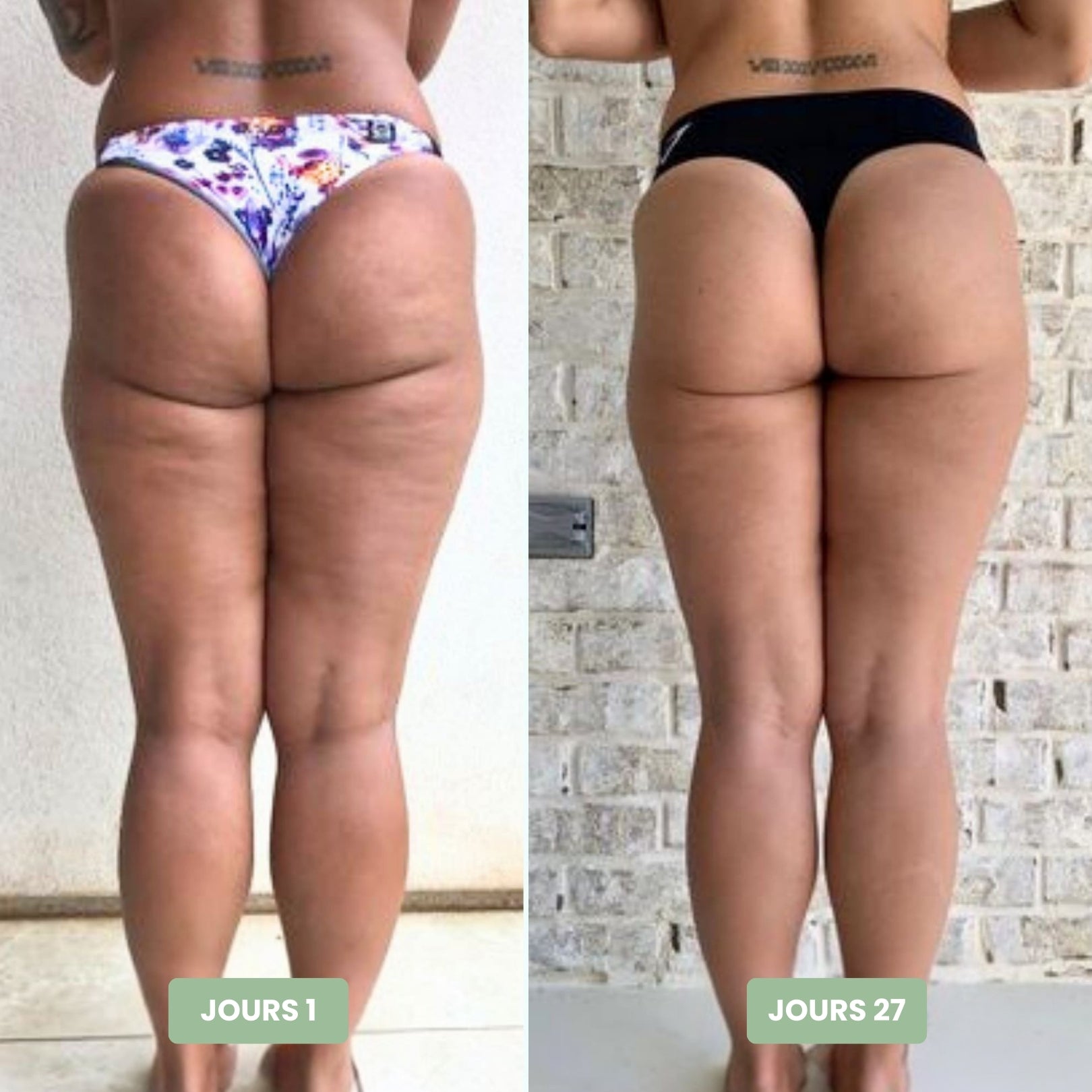 Vibraskin® - Appareil anti-cellulite à micro vibrations