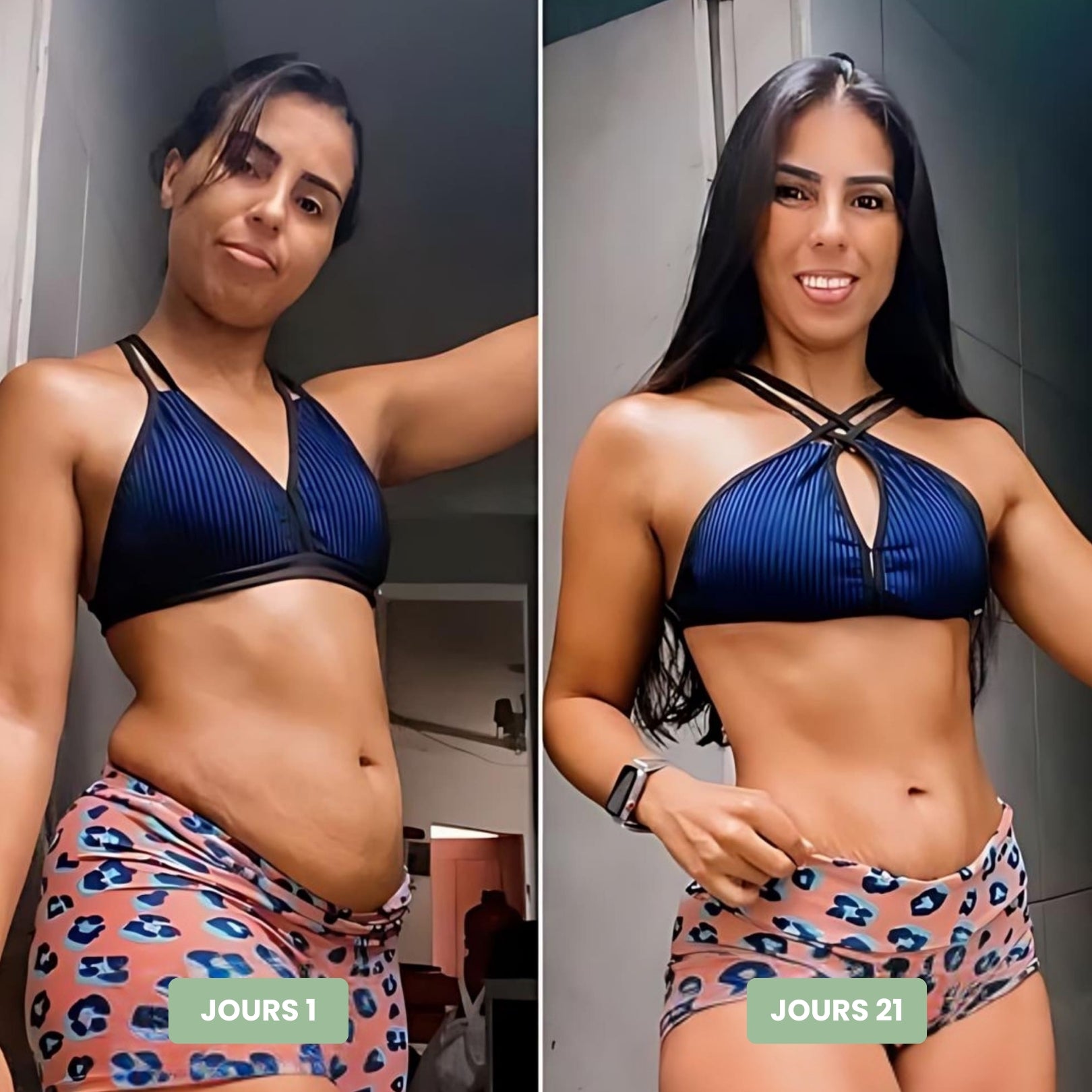 Vibraskin® - Appareil anti-cellulite à micro vibrations