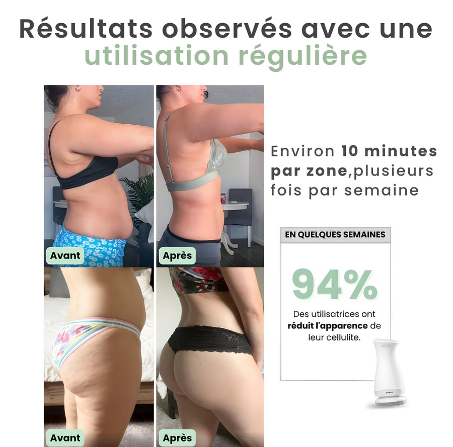 Vibraskin® - Appareil anti-cellulite à micro vibrations